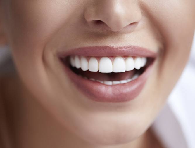 Closeup of smile with durable porcelain veneers