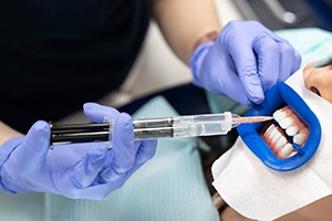 Close-up of gums receiving antibiotic gel 