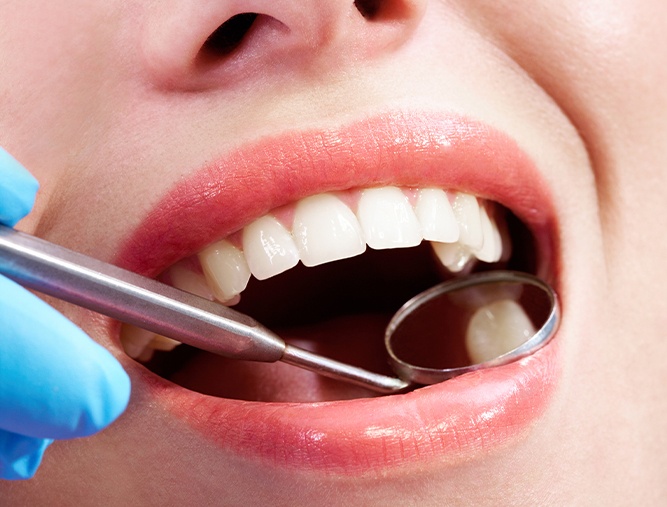 Dentist checking patient's smile after tooth colored fillings