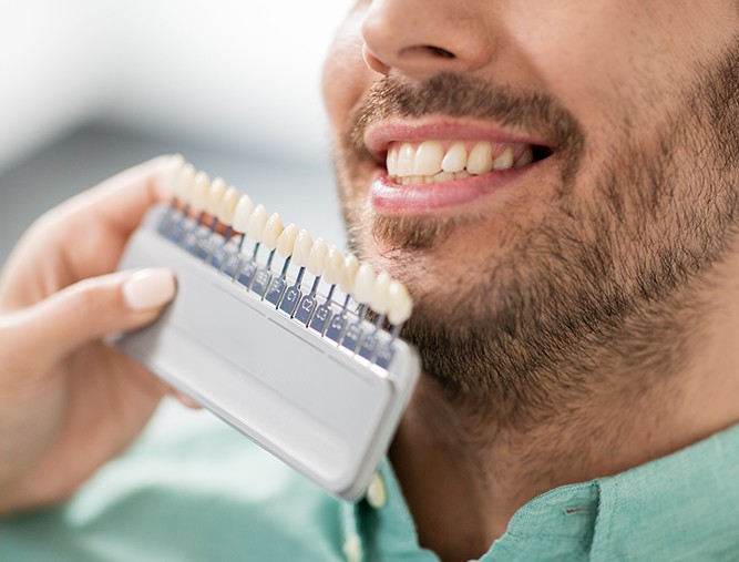 Man's smile compared with porcelain veneer shade chart