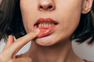 Lady shows inflamed gums