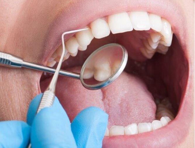 Person undergoing an oral cancer screening in Austin