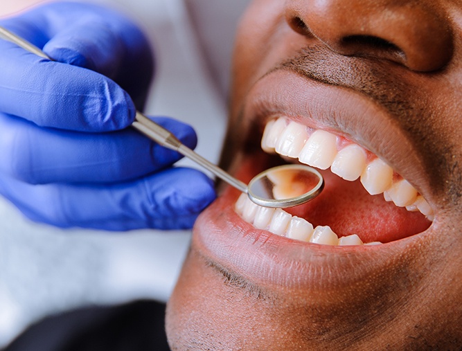 Dentist checking patient's tooth colored dental restorations