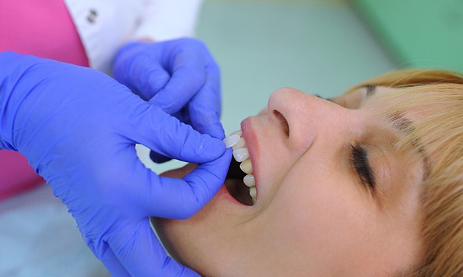 Woman receiving dental veneers