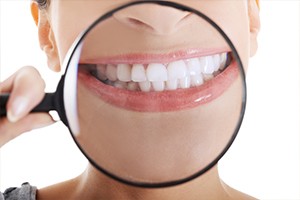 Patient's smile after in office Zoom teeth whitening treatment