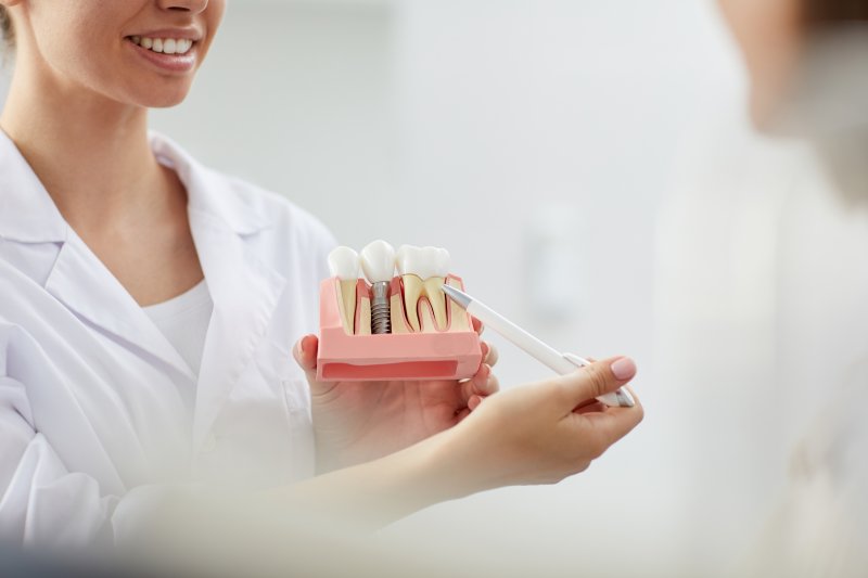 a dentist showing a patient a model of dental implants