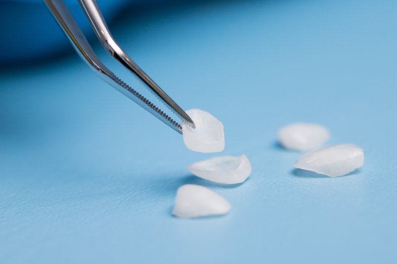 A closeup of tweezers holding a dental veneer